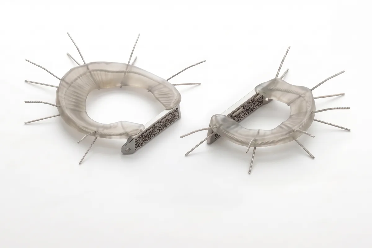 Two LunaFlex implants side by side, one configured for the medial meniscus and one for the lateral, each with peripheral suture strands and a fixation bridge.