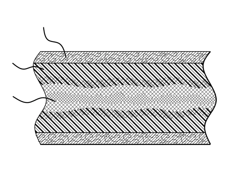Patent-style cross-section drawing of the implant wall, showing the reinforced composite core layered between outer scaffold surfaces.